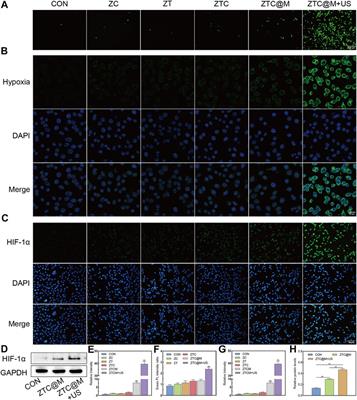 Biomimetic Metal-Organic Framework Nanoparticles for Synergistic Combining of SDT-Chemotherapy Induce Pyroptosis in Gastric Cancer